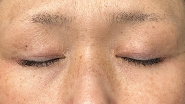 Preoperative Condition Part 1