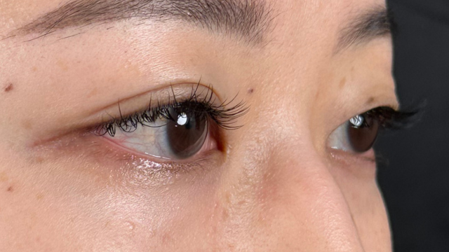 Preoperative Condition Part 1