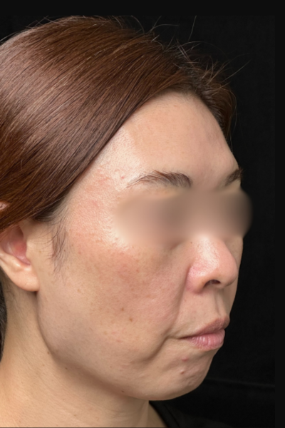 Preoperative Condition Part 1