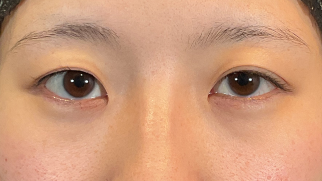 Preoperative Condition Part 1