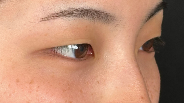 Preoperative Condition Part 1