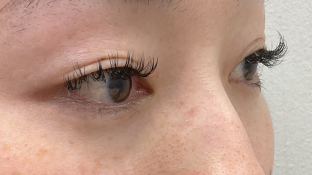 Preoperative Condition Part 1