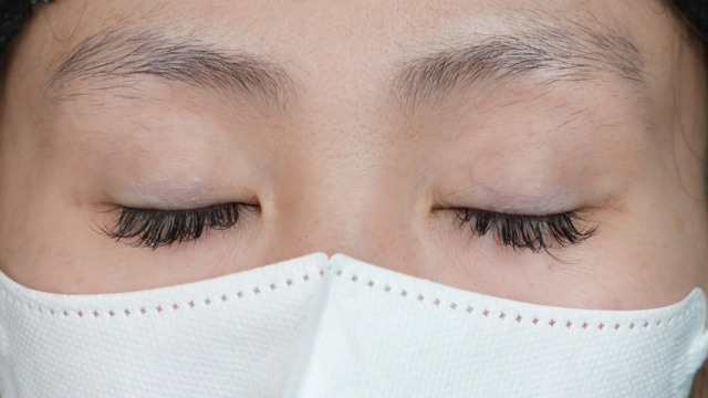 Preoperative Condition Part 1