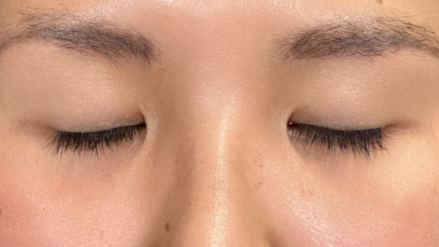 Preoperative Condition Part 1