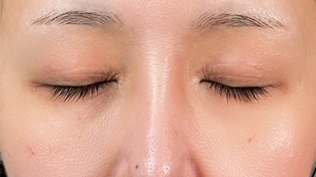 Preoperative Condition Part 1