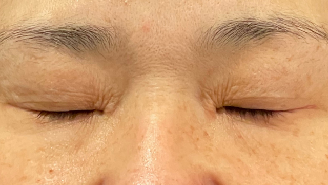 Preoperative Condition Part 1