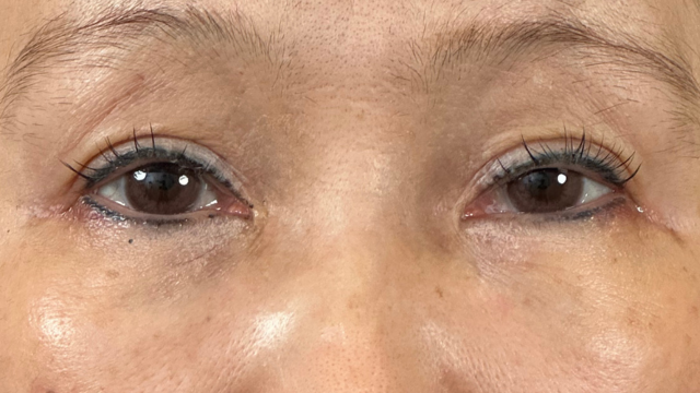 Preoperative Condition Part 1