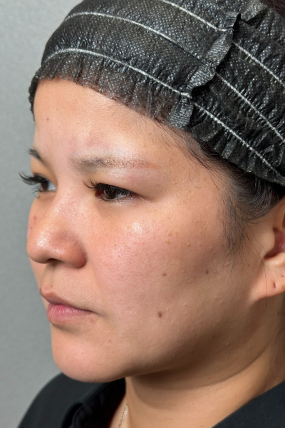 Preoperative Condition Part 1