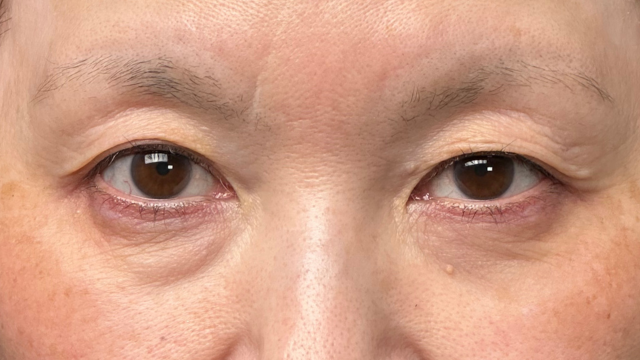 Preoperative Condition Part 1