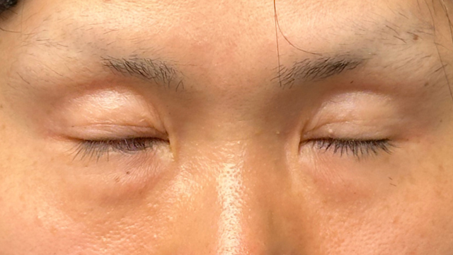 Preoperative Condition Part 1