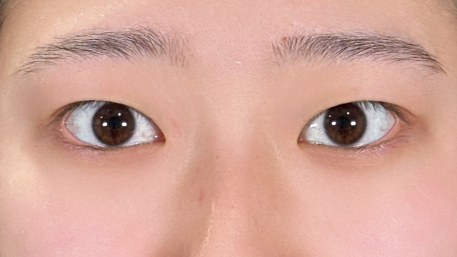 Preoperative Condition Part 1