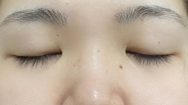 Preoperative Condition Part 1