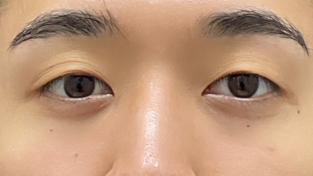 Preoperative Condition Part 1