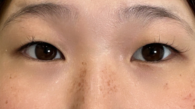 Preoperative Condition Part 1