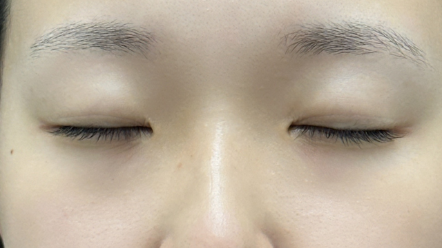 Preoperative Condition Part 1