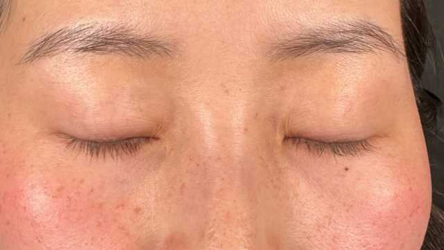 Preoperative Condition Part 1