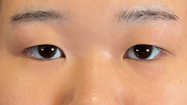 Preoperative Condition Part 1