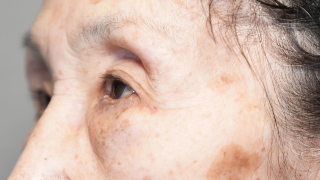 Preoperative Condition Part 1