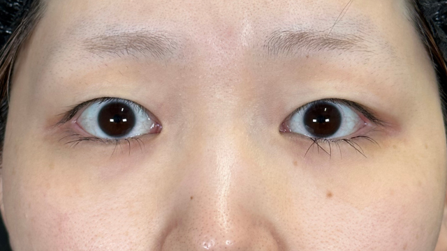 Preoperative Condition Part 1