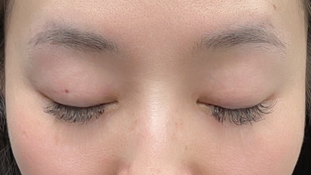 Preoperative Condition Part 1