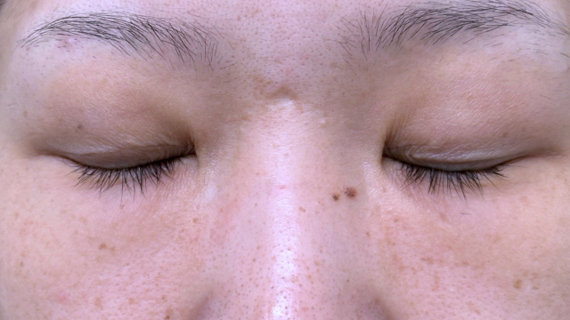 Preoperative Condition Part 1