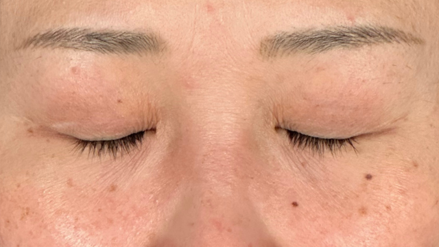 Preoperative Condition Part 1