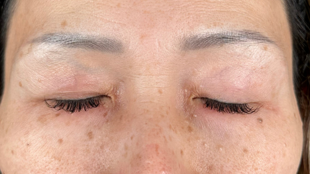 Preoperative Condition Part 1