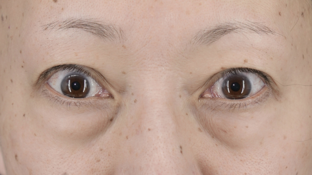 Preoperative Condition Part 1