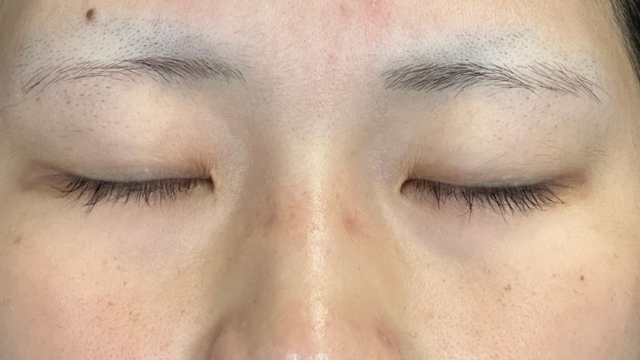 Preoperative Condition Part 1