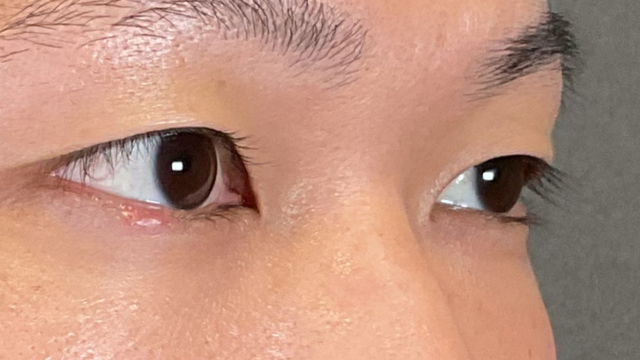 Preoperative Condition Part 1