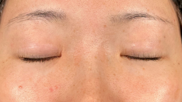 Preoperative Condition Part 1