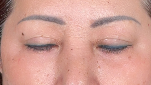 Preoperative Condition Part 1