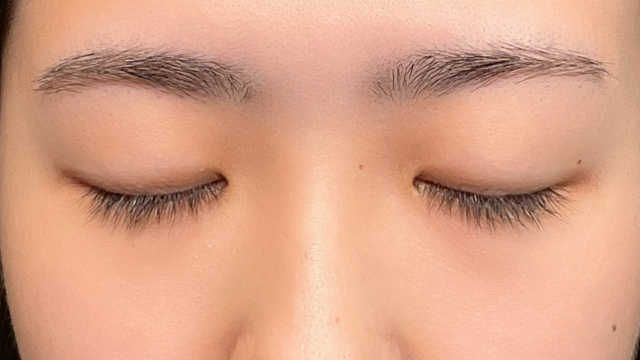 Preoperative Condition Part 1