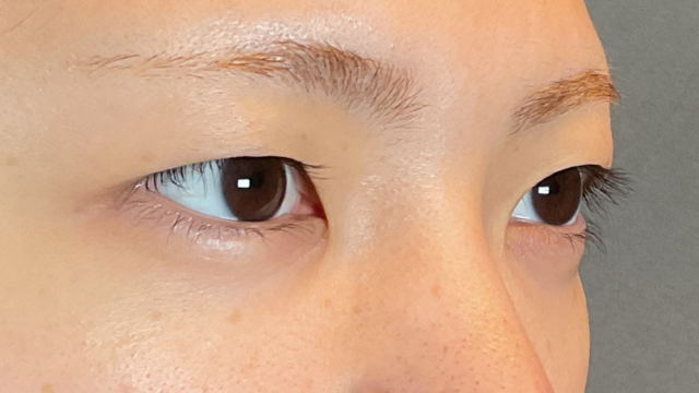 Preoperative Condition Part 1