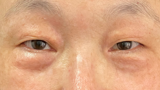 Preoperative Condition Part 1