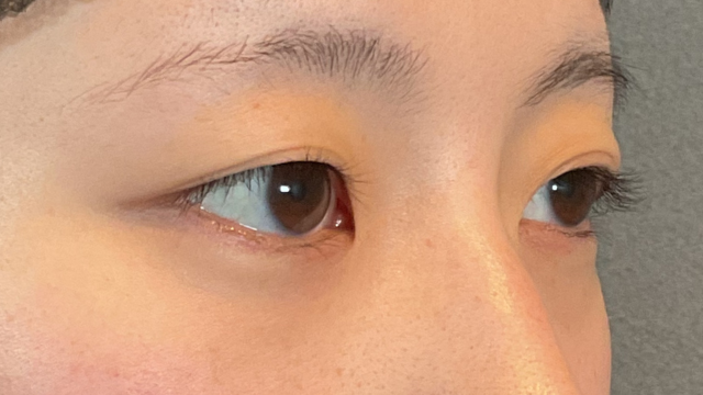 Preoperative Condition Part 1