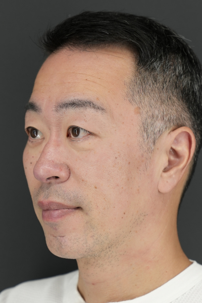 Preoperative Condition Part 1