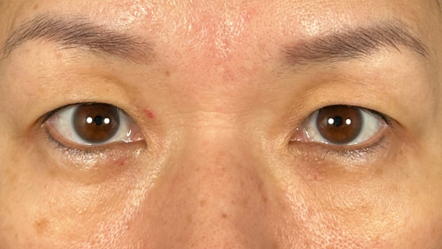 Preoperative Condition Part 1