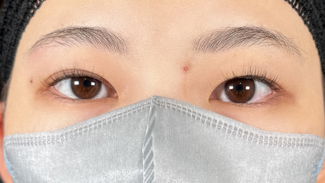 Preoperative Condition Part 1