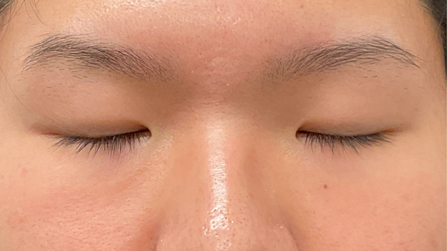 Preoperative Condition Part 1