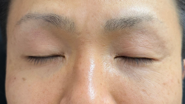 Preoperative Condition Part 1