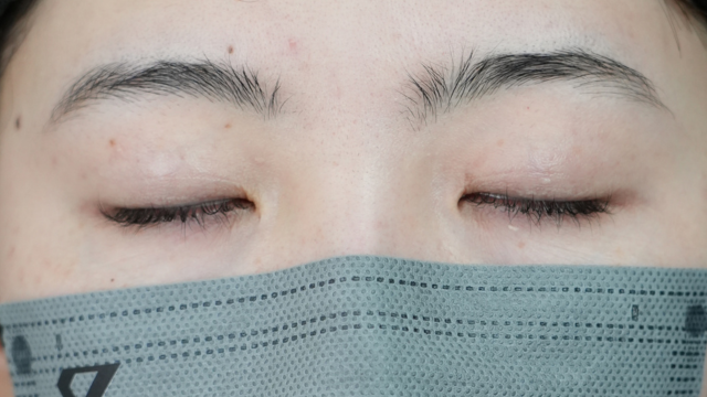 Preoperative Condition Part 1