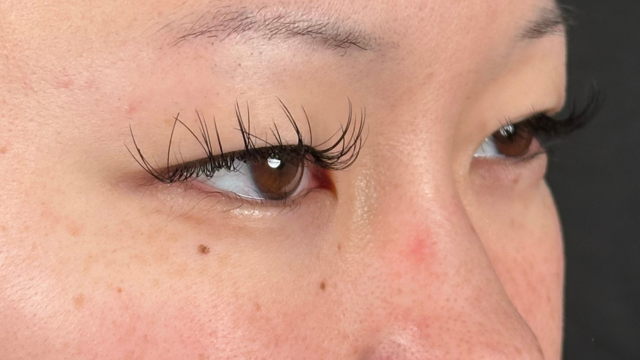 Preoperative Condition Part 1