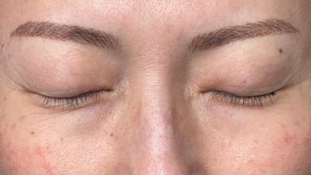 Preoperative Condition Part 1