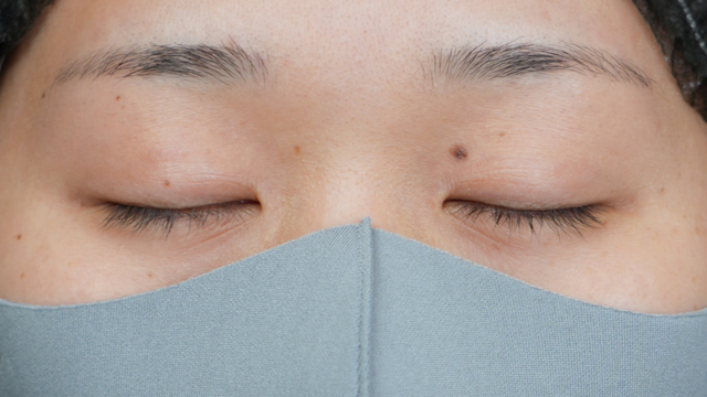 Preoperative Condition Part 1