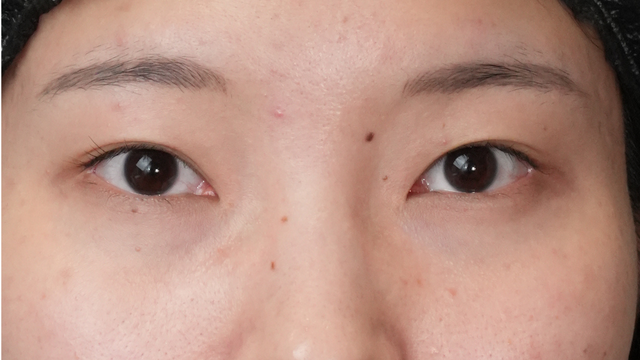 Preoperative Condition Part 1