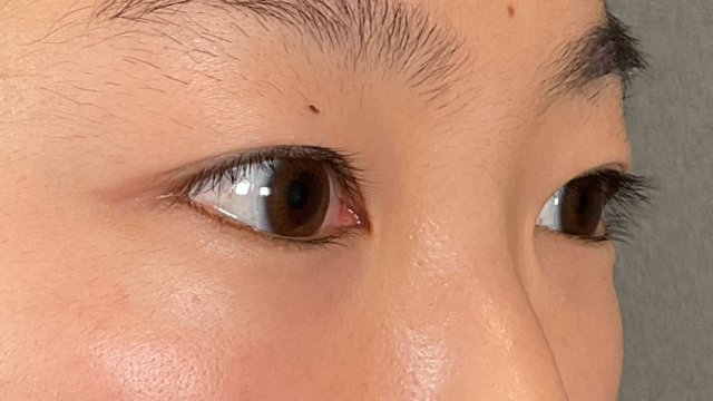 Preoperative Condition Part 1