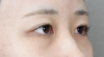 Preoperative Condition Part 1