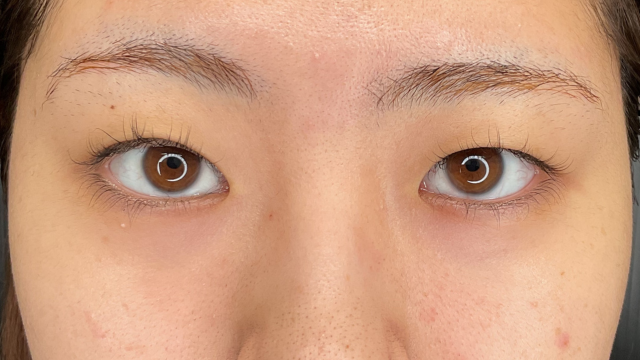 Preoperative Condition Part 1