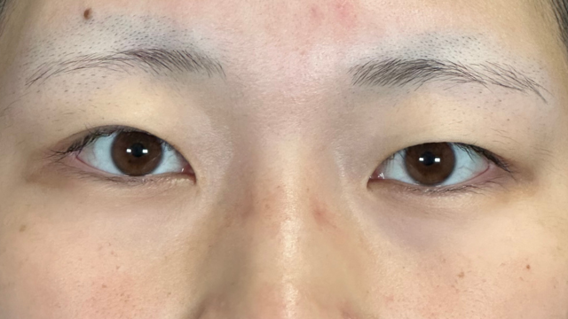 Preoperative Condition Part 1